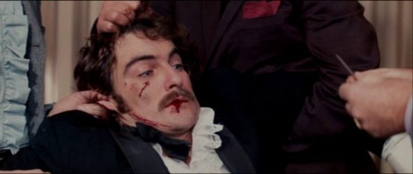 loose-lips get throats cut